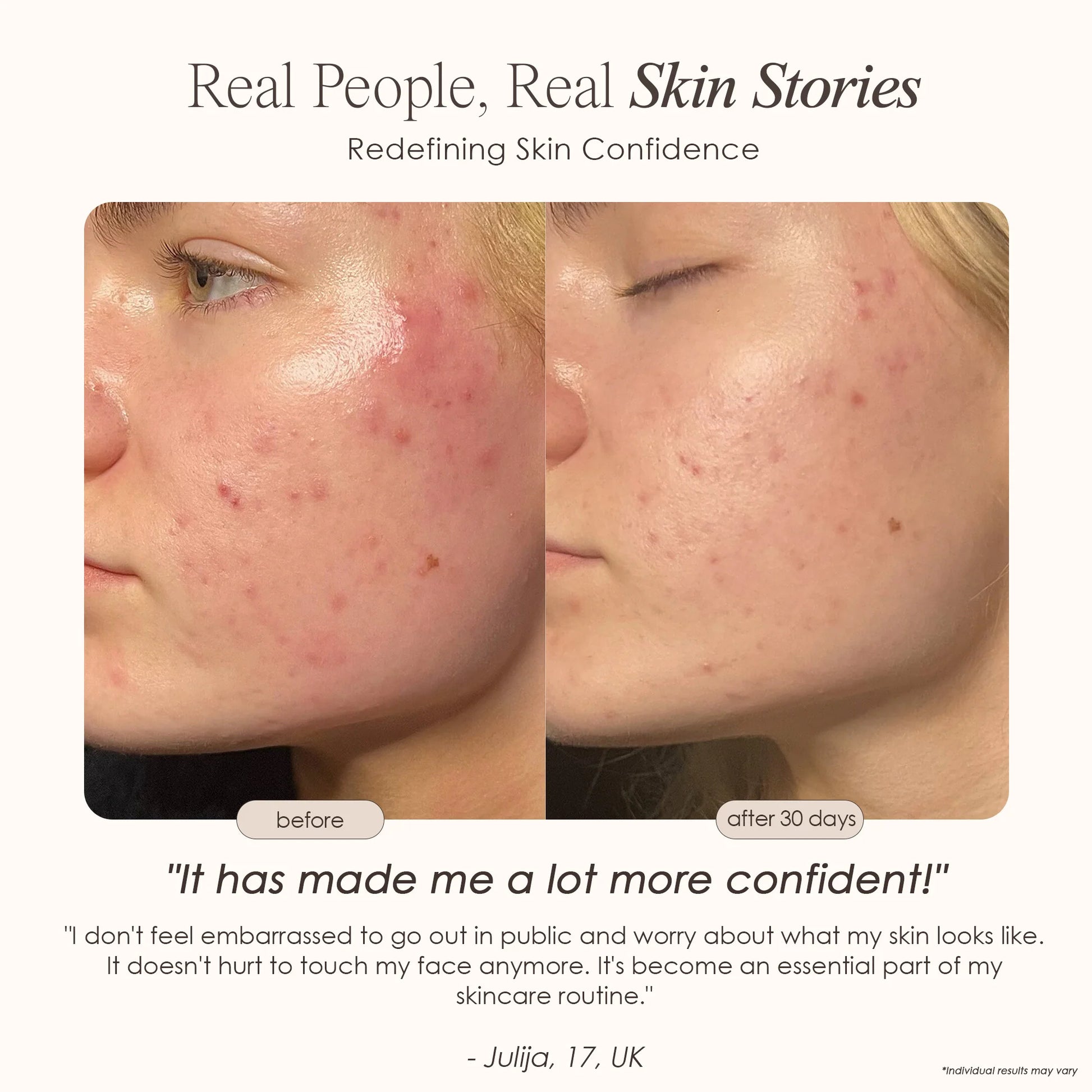 Lightaura | LED Face Mask