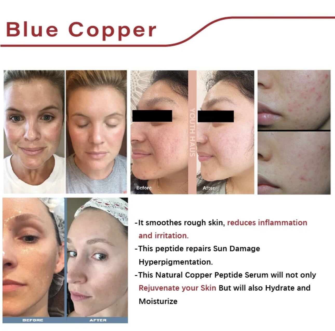 BLUE 🔹Copper Peptide GHK-CU Serum with Hyaluronic Acid anti Wrinkle Assortment